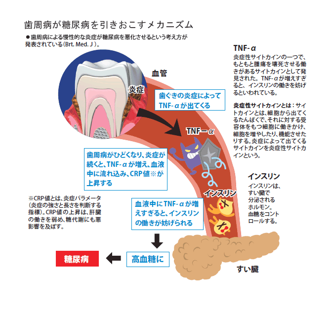 03糖尿病と歯周病治療.gif