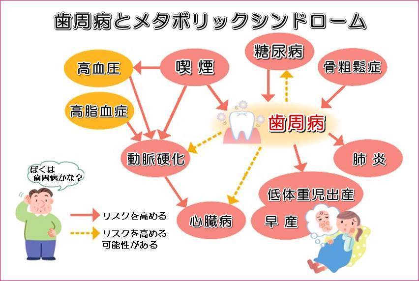 歯周病とメタボリックシンドローム図.jpg