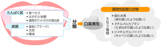 口臭治療概念図01.gif