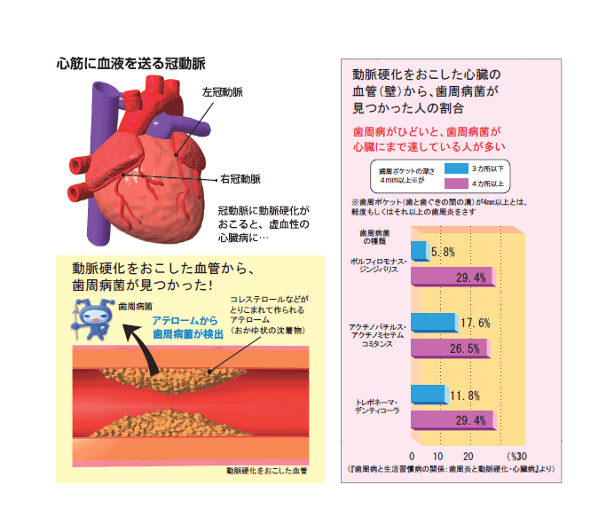 04心臓病と歯周病予防.gif