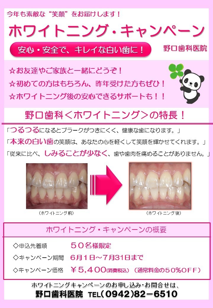 【2017年版】ホワイトニングキャンペーンチラシ【提案版】.jpg