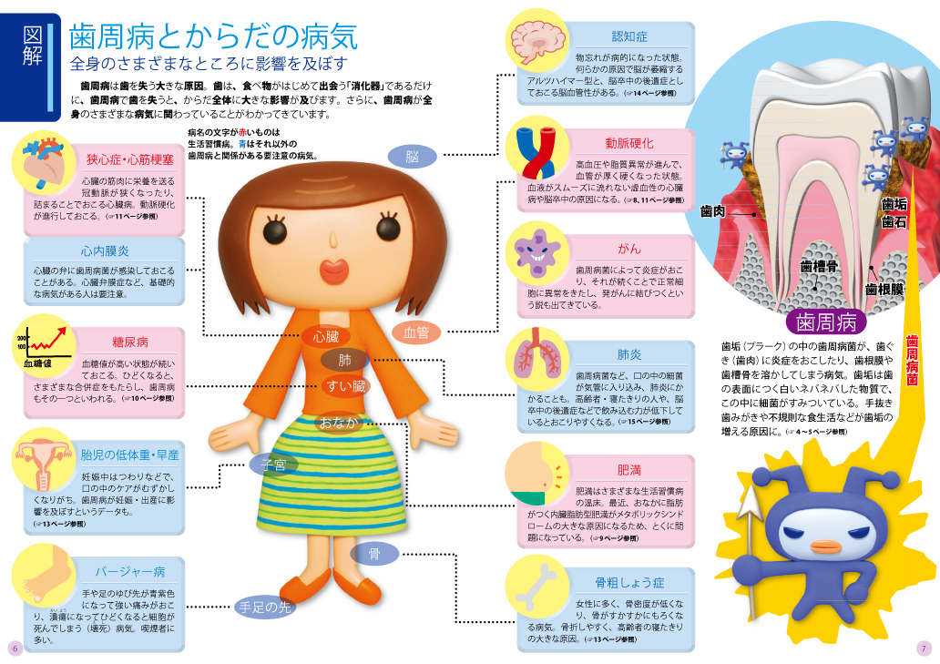 歯周病と全身健康【全体図】.jpg