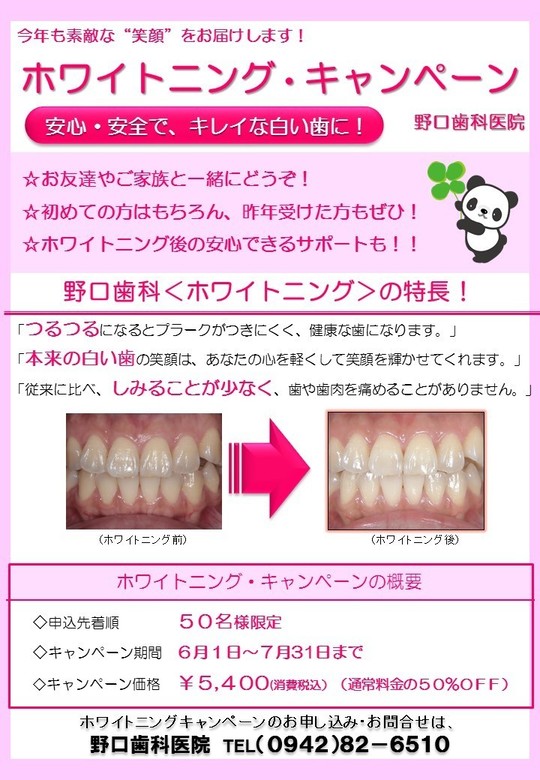 【2017年版】ホワイトニングキャンペーンチラシ【提案版】.jpg